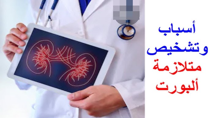 اسباب متلازمة ألبورت الوراثية